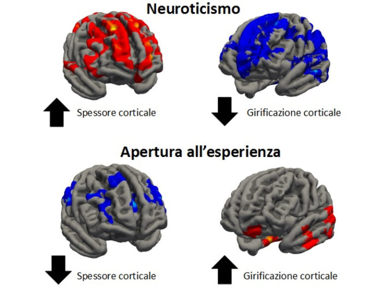 Dimmi che forma ha il tuo cervello e ti dirò chi sei