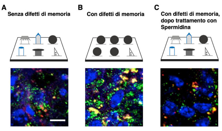 La molecola che ripulisce la nostra memoria